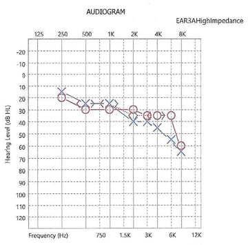 Stress-and-Hearing-Loss-A-Case-Study-of-Ms.-Limas-Journey-to-Improved-Auditory-Health Linner