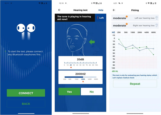 How to Read an Audiogram: A Guide from audiologists - Linner