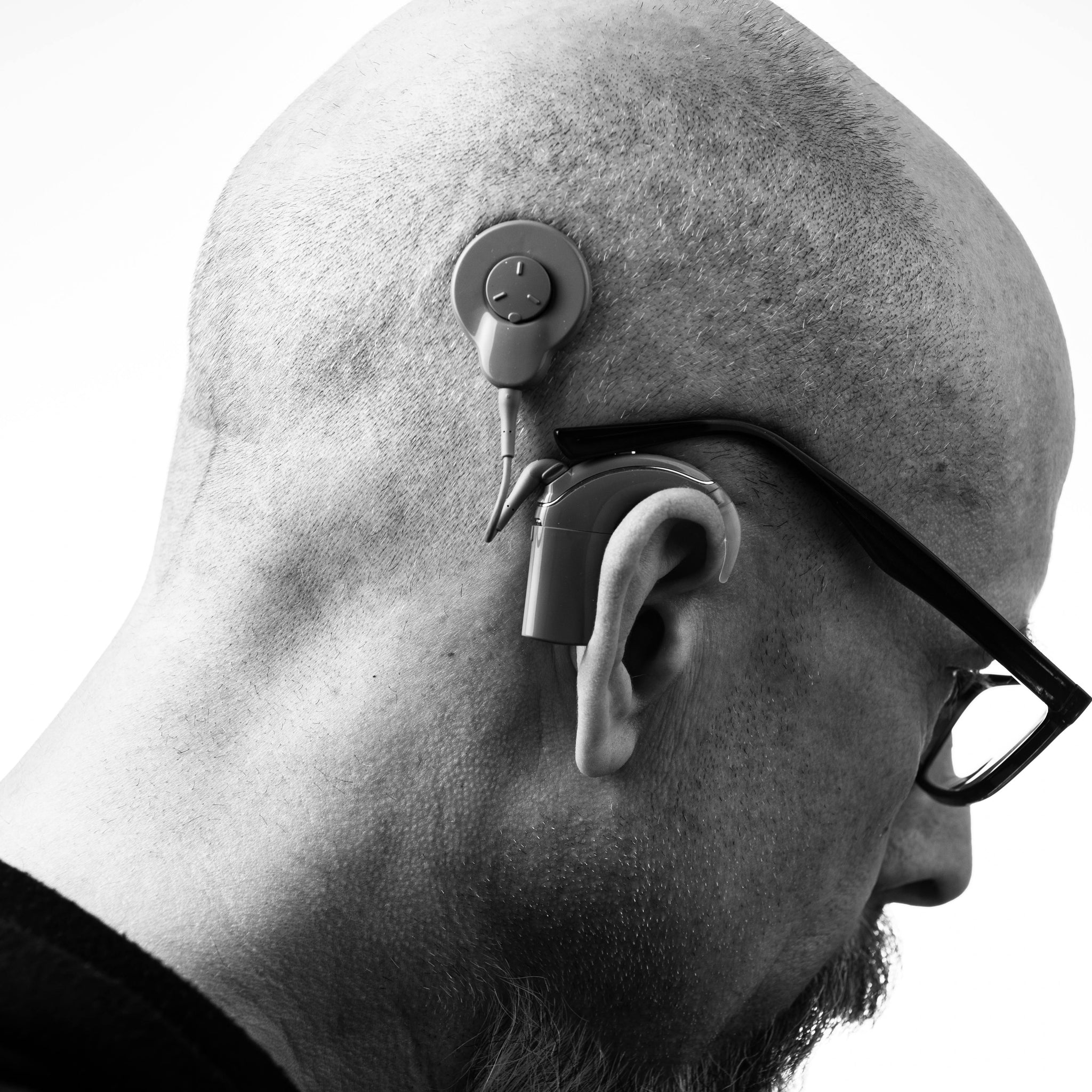 Can Hearing Loss Be Reversed? A Look at New Medical Advances